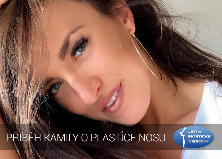 plastika nosu zkušenosti