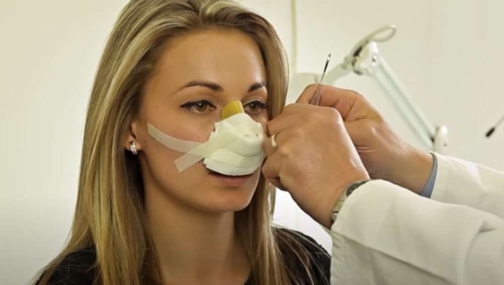 Postoperative Care – Nose Packing Removal after Rhinoplasty