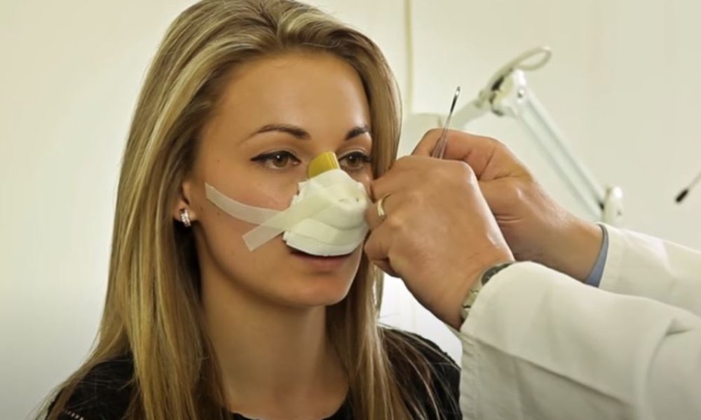 Nose packing removal after nose surgery UEM Prague